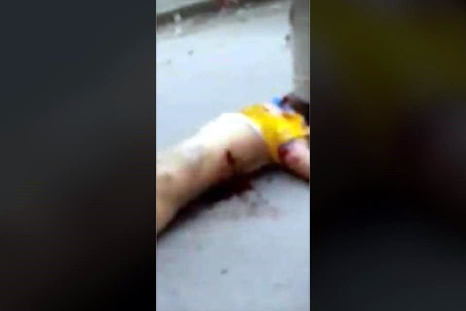 La Cruz Roja informó que el aficionado presenta una herida punzocortante a la altura del pulmón derecho, golpes y heridas en el cráneo.