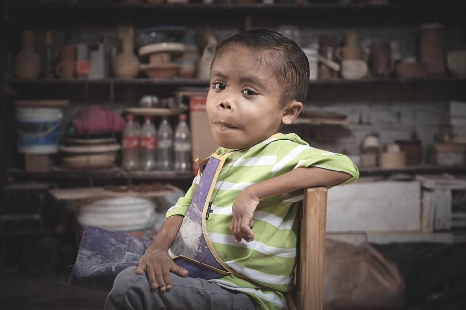 'Migue' viene de una familia de artesanos, y pese a sus enfermedades ha destacado en el Premio Nacional de Cerámica, ¡con tan sólo 10 años!.