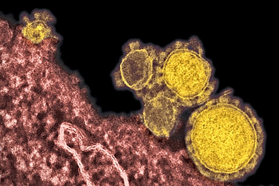 Tras reunión, SSJ y CEVE acordaron reforzar medidas de vigilancia epidemiológica para hacerle frente al coronavirus.