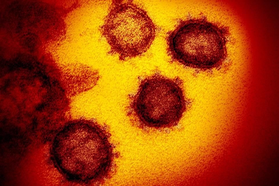 Imagen de microscopio electrónico de los Institutos Nacionales de Salud de EU muestran el nuevo coronavirus SARS-CoV-2.