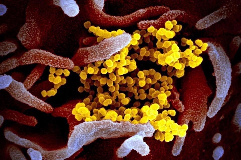 Imagen microscópica del coronavirus.