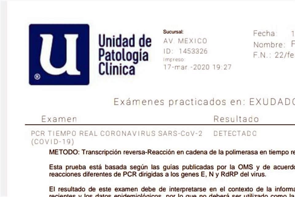 El resultado del laboartorio indica que es positivo.