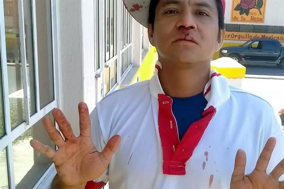 Patricio Nava fue atendido en la Cruz Verde y relató que fue golpeado por una persona con acento extranjero.