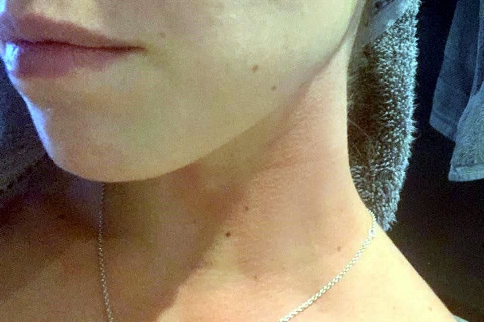 Alondra Torres, especialista en otorrinolaringología, fue agredida con cloro en la cara, cuando salió ayer a pasear a su mascota en Zapopan.