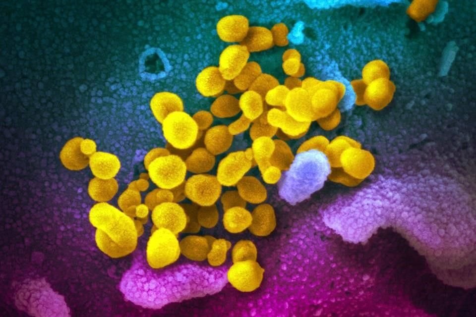 La FDA advirtió a consumidores que no hay evidencia científica de que el dióxido de cloro ayude contra el coronavirus.