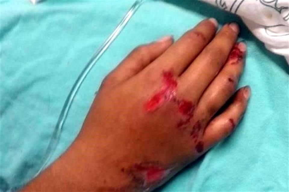 En 2014, tras ser impactada presuntamente por el auto de Yigal, Leslie tuvo fractura en fémur y muñeca.