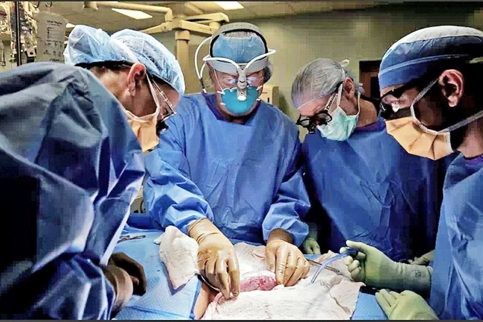 Un riñón porcino fue aceptado por el cuerpo de una mujer en septiembre de 2021 en la Universidad de Nueva York.