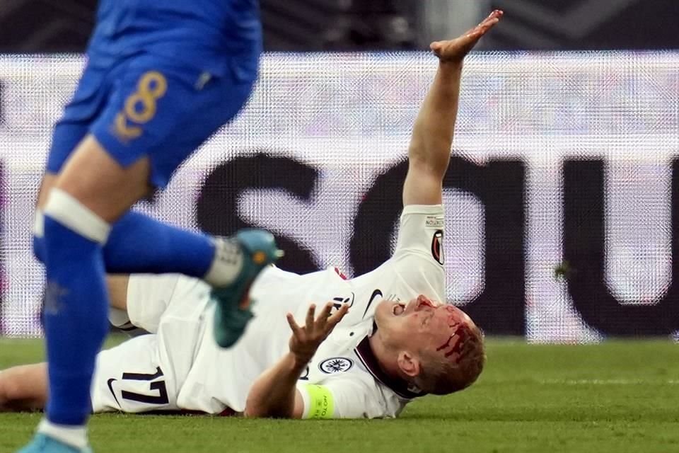 En los primeros minutos, Sebastian Rode recibió un golpe en la cabeza y tuvo que ser atentido.