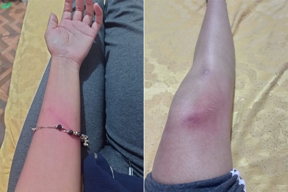 Alicia Rubí Landeros Gómez señaló que ha sido víctima de lesiones.
