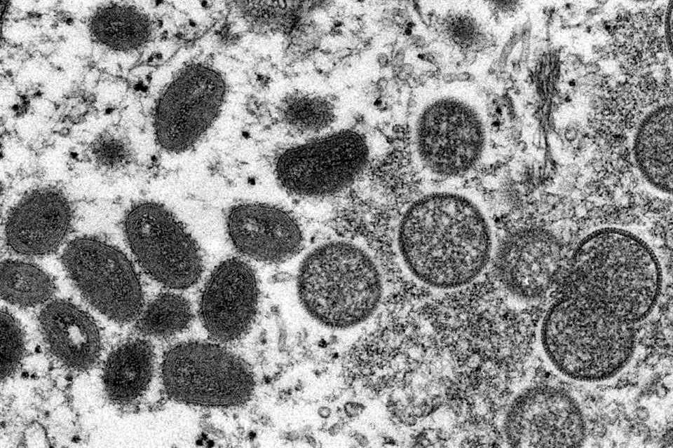 A la izquierda, muestra microscópica de viriones maduros de la viruela del mono.