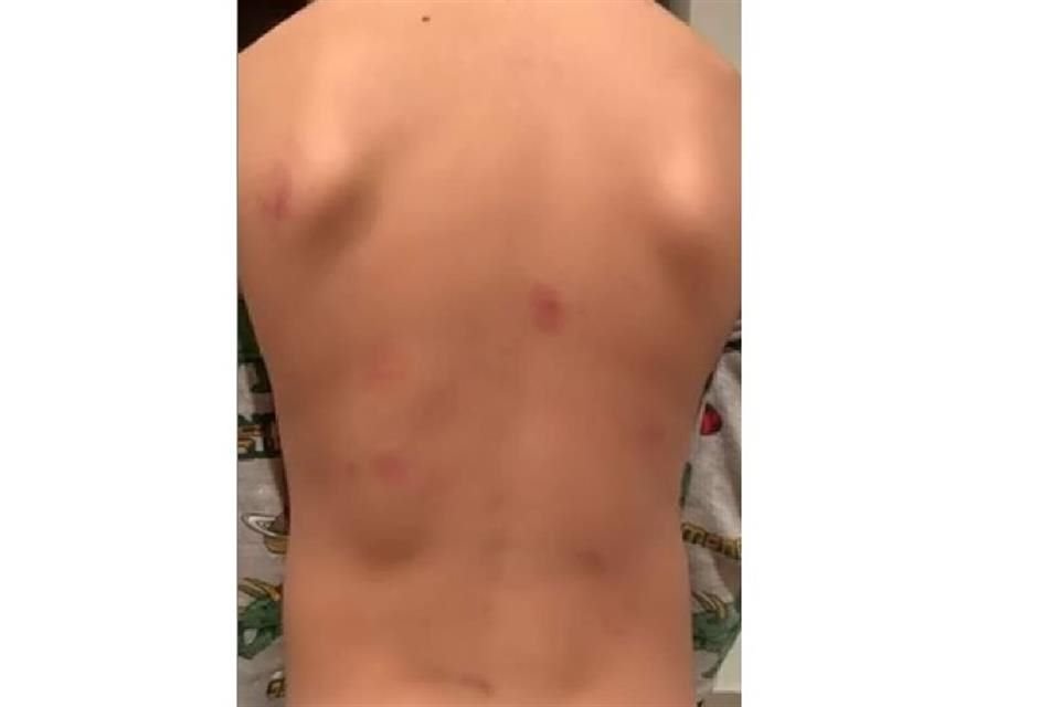 La mamá del menor, Ángela María Barba Ascencio, acusó que su hijo ha llegado con golpes.