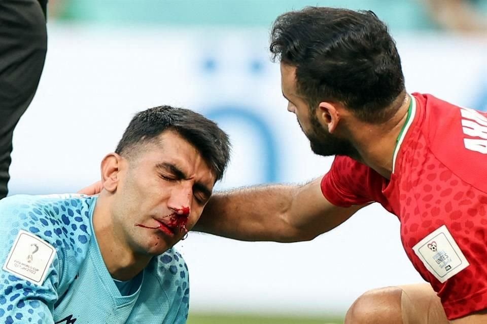 Así quedó el rostro de Beiranvand tras el encontronazo.