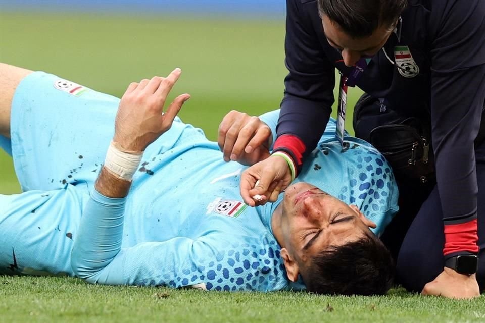 El arquero Alireza Beiranvand tuvo que dejar el partido tras chocar su cara con otro compañero.