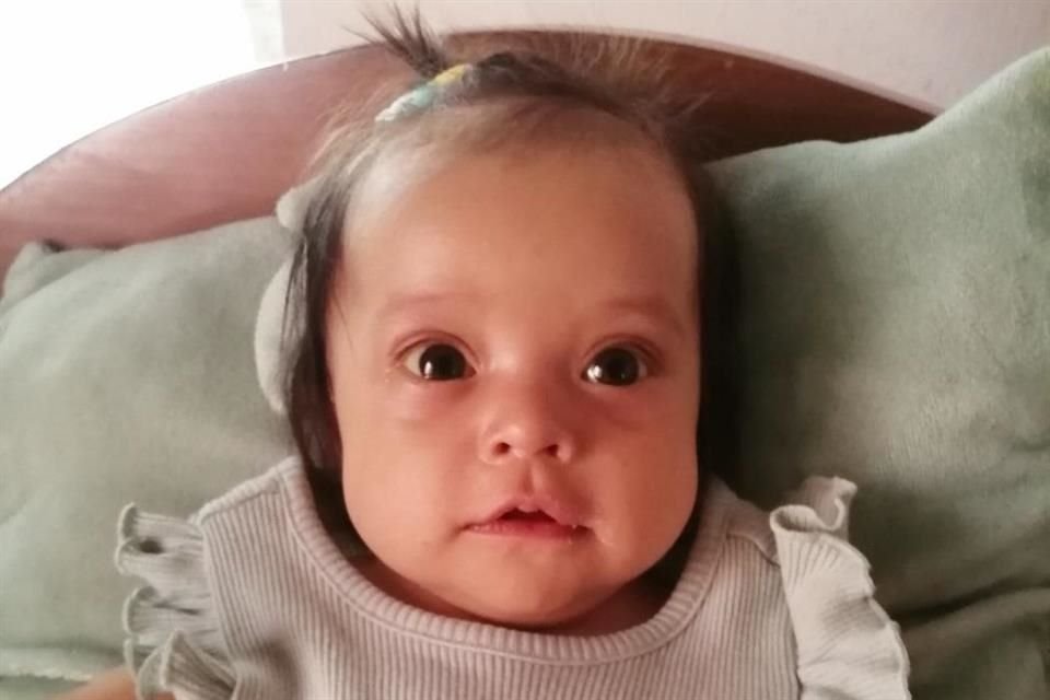 Aitana tiene cinco meses y necesita con mucha urgencia un transplante de hígado. Su familia debe reunir cerca de millón y medio de pesos.