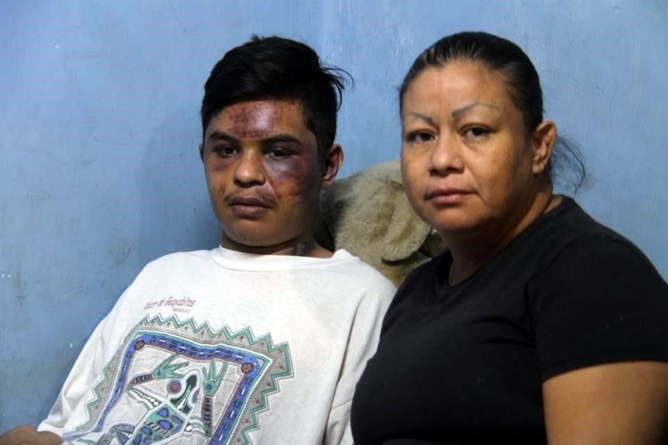 José de Jesús fue golpeado y subido a una patrulla el pasado 27 de diciembre, en el Parque Rojo, en Guadalajara.