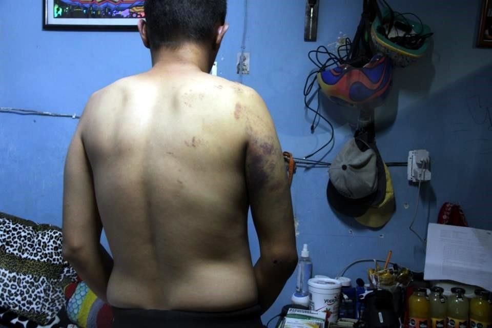 Después de detenerlo en el Parque Revolución, policías golpearon a José de Jesús y le preguntaron si quería ser un desaparecido más.