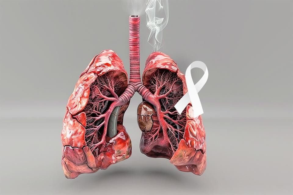 El cáncer de pulmón es un asesino silencioso, pues en su etapa inicial es totalmente asintomático.