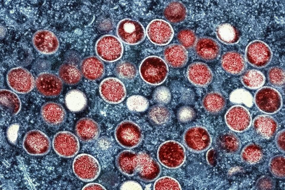 La alerta por mpox en Puerto Vallarta se activó luego de que un paciente con sospecha de la enfermedad escapó de un hospital de Nayarit.