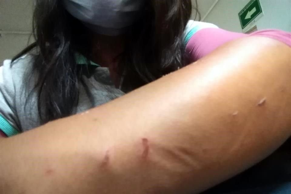 'Susana' teme por su vida por las constantes agresiones de sus vecinos.