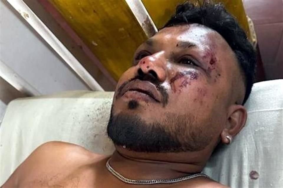 Una persona sobrevivió al accidente del Boeing 787 de Air India con destino Londres, que se estrelló con 242 personas a bordo.