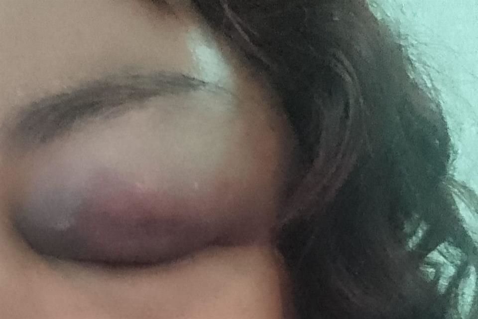Una de las víctimas estuvo incapacitada 22 días.
