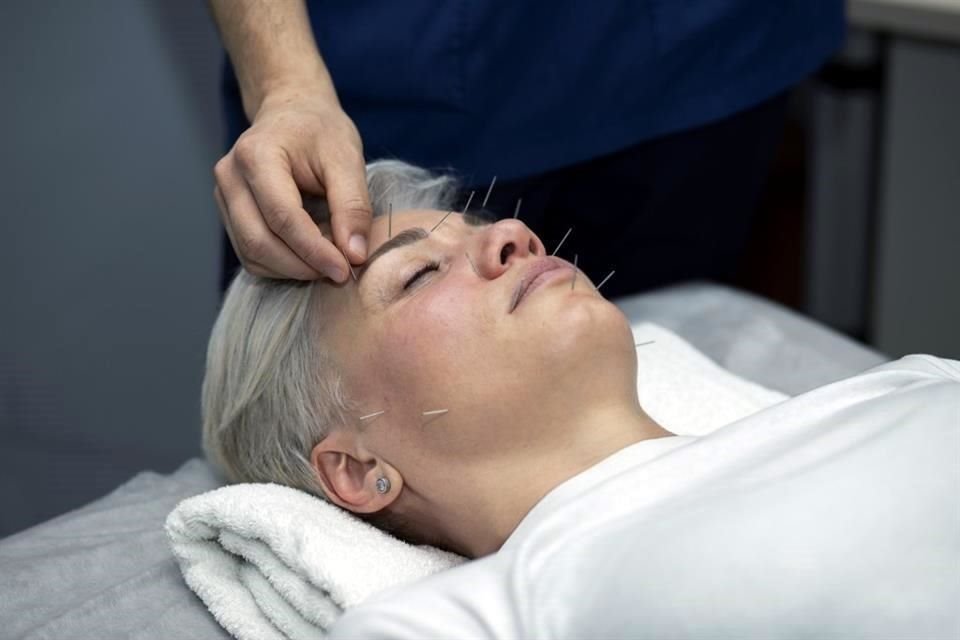 Expertas explican la tendencia 'notox', que consiste en usar métodos tradicionales en lugar de químicos o rellenos para mejorar la piel.