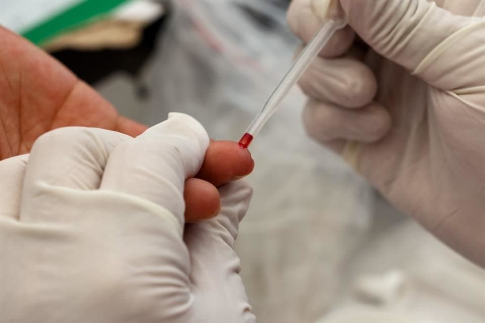 En Jalisco, en 2025 se registraron 822 nuevos casos de VIH.