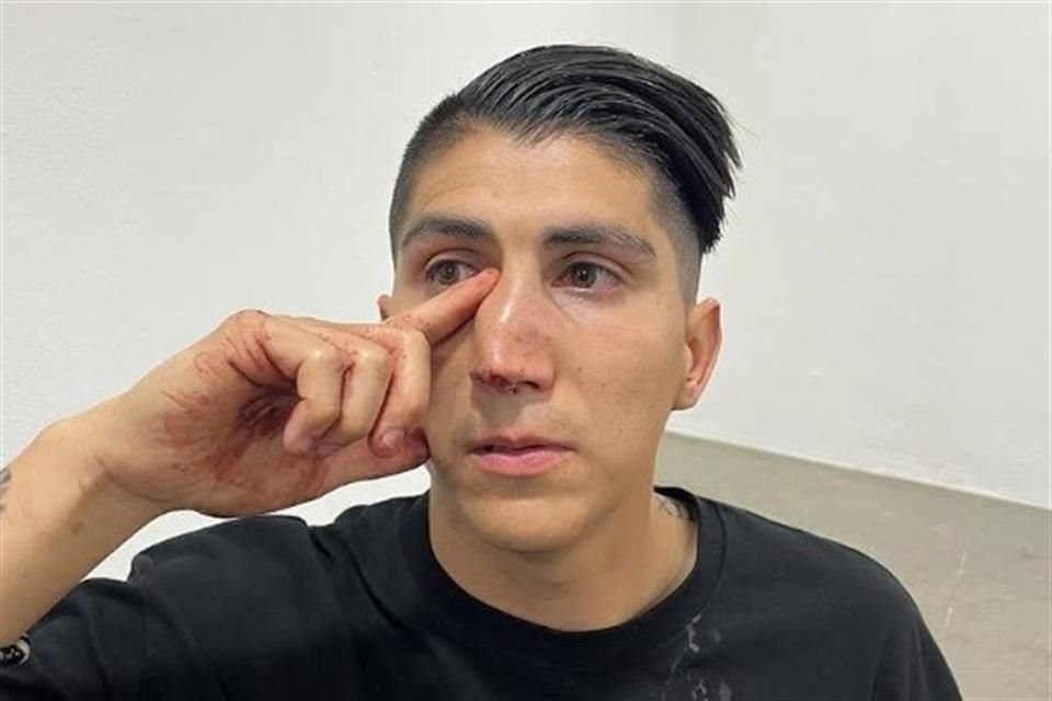 Hermano de Ángel Zaldívar fue atacado tras el partido entre Chivas y Juárez.